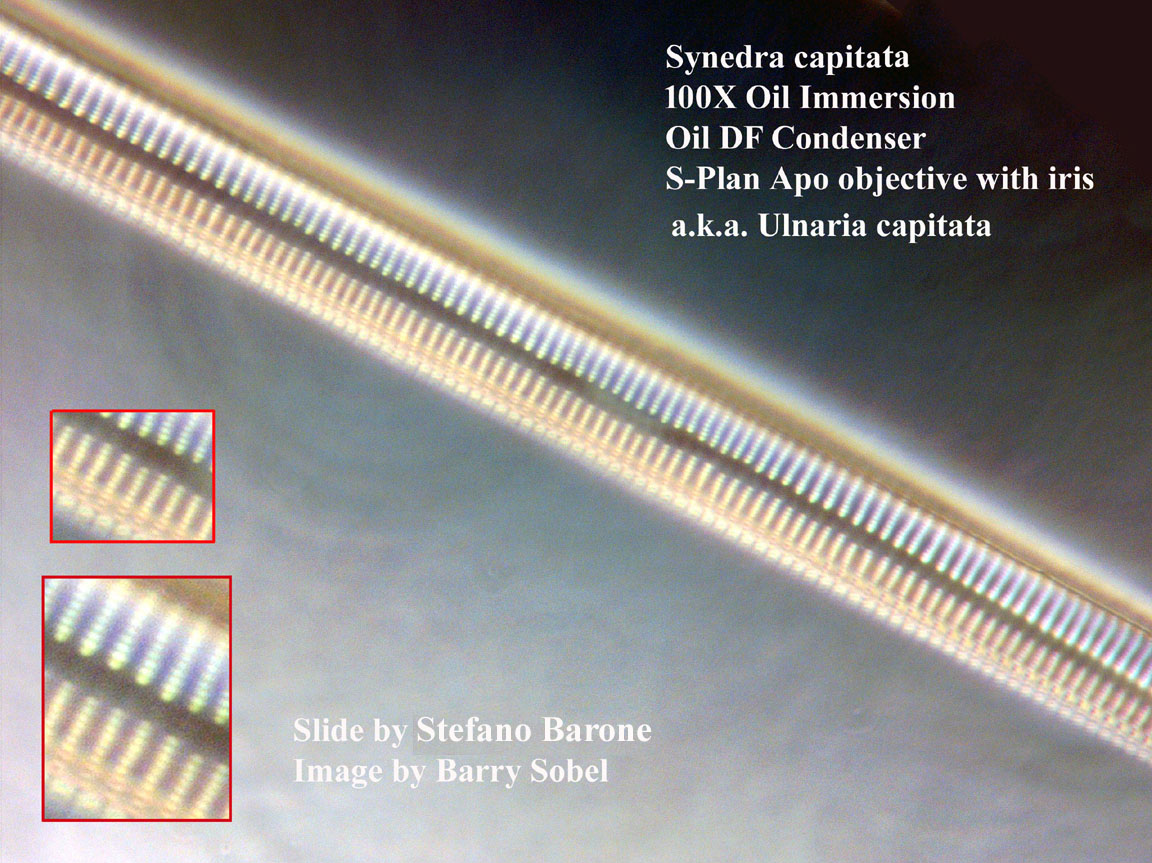 diatom